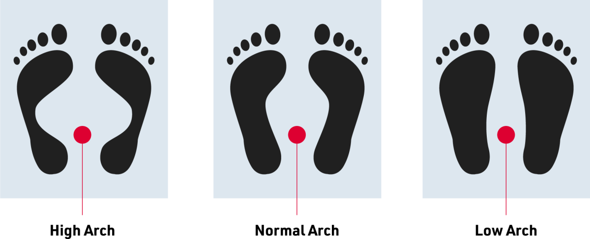 Foot types