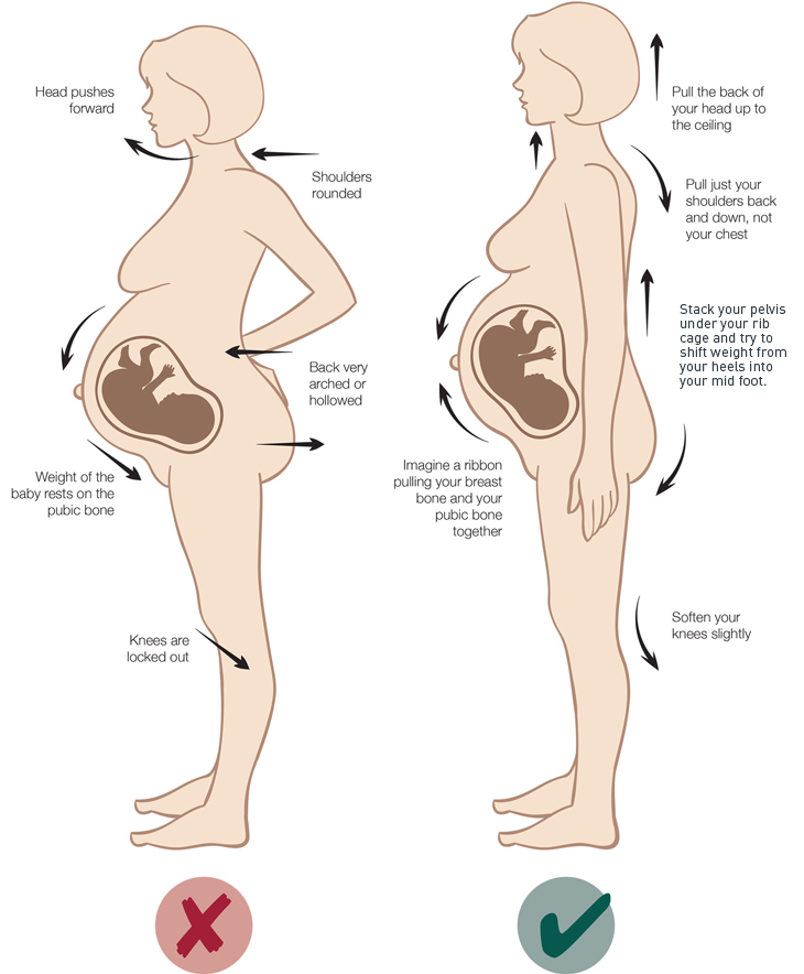 image indicating different appropriate postures for someone whos pregnant